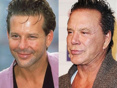 A picture of Mickey Rourke before (left) and after (right).